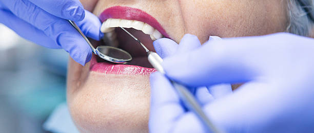 Best Emergency Root Canal Treatment in Dunkirk, NY